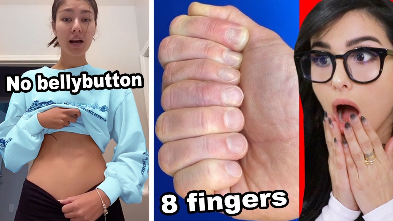 People With Unique Features On Tik Tok