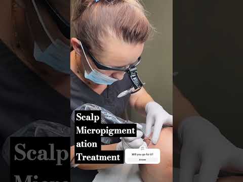 Scalp Micropigmentation solution for hair loss,...