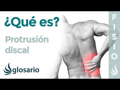 PROTRUSIÓN DISCAL | Qué es, síntomas, signos clínicos, causas y tratamiento fisioterapéutico