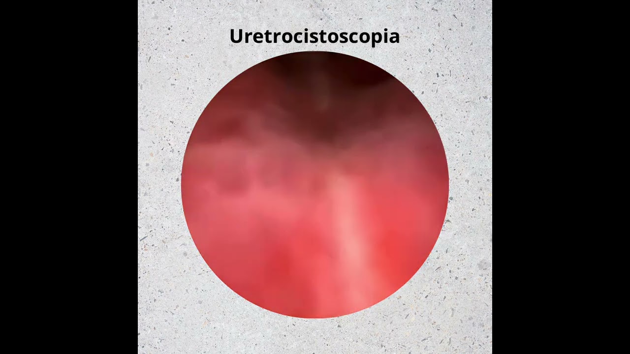 Luis Susanibar Napuri-26