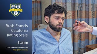 Staring | Bush-Francis Catatonia Rating Scale