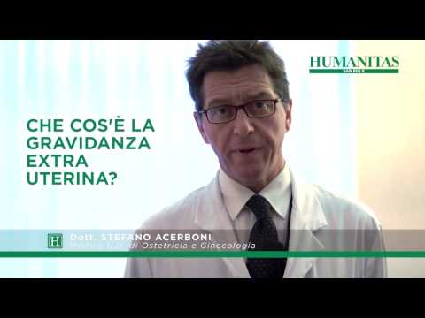 Il bordo della spalla osteophyte articolazione Glicina per il mal di schiena