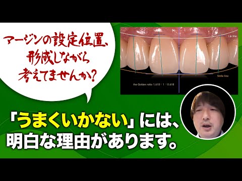 クラウン(歯)について詳しく解説