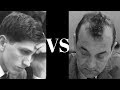 Bobby Fischer's Fischer-Sozin attack vs Viktor ...