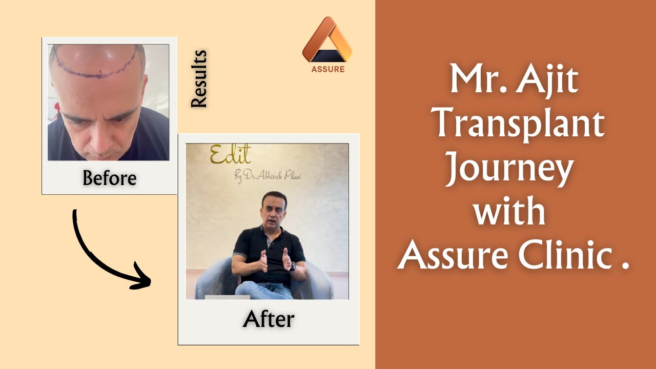 Mr. Ajit — Age Reversal — Assure Clinic Mumbai