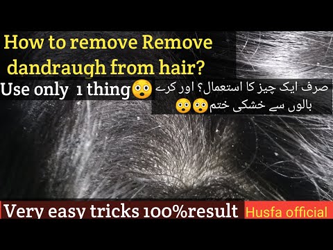 How to  remove dandraugh? dandruf treatment at home#husfa official #dantruf#hair care