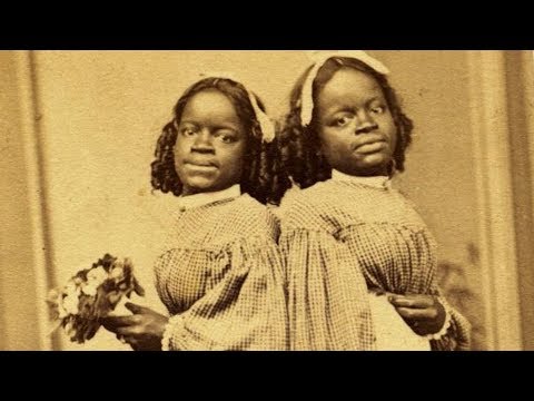 The Most Bizarre Freak Show Acts Ever