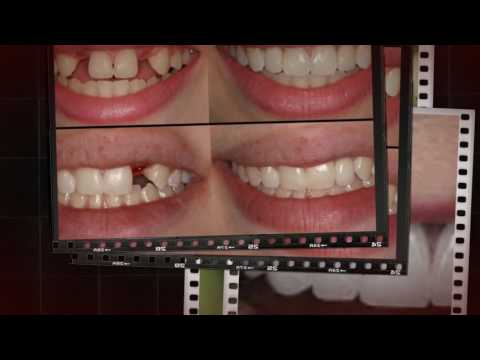 download lagu mp3 mp4 Best Dentist In Viman Nagar, download lagu Best Dentist In Viman Nagar gratis, unduh video klip Best Dentist In Viman Nagar