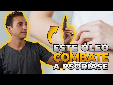 PSORÍASE, VOCÊ TEM OU CONHECE ALGUÉM QUE TEM?