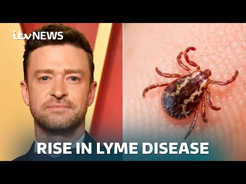 UK health agency issues alert over Lyme disease as Justin Timberlake announces diagnosis | ITV News