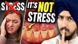 You Don't Grind Your Teeth Because You're Stressed