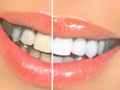 download lagu mp3 mp4 Dentist Santa Barbara, download lagu Dentist Santa Barbara gratis, unduh video klip Dentist Santa Barbara