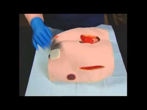 Foam Wound Dressings | Absorbent Wound Dressings | Primary Wound Dressings Video