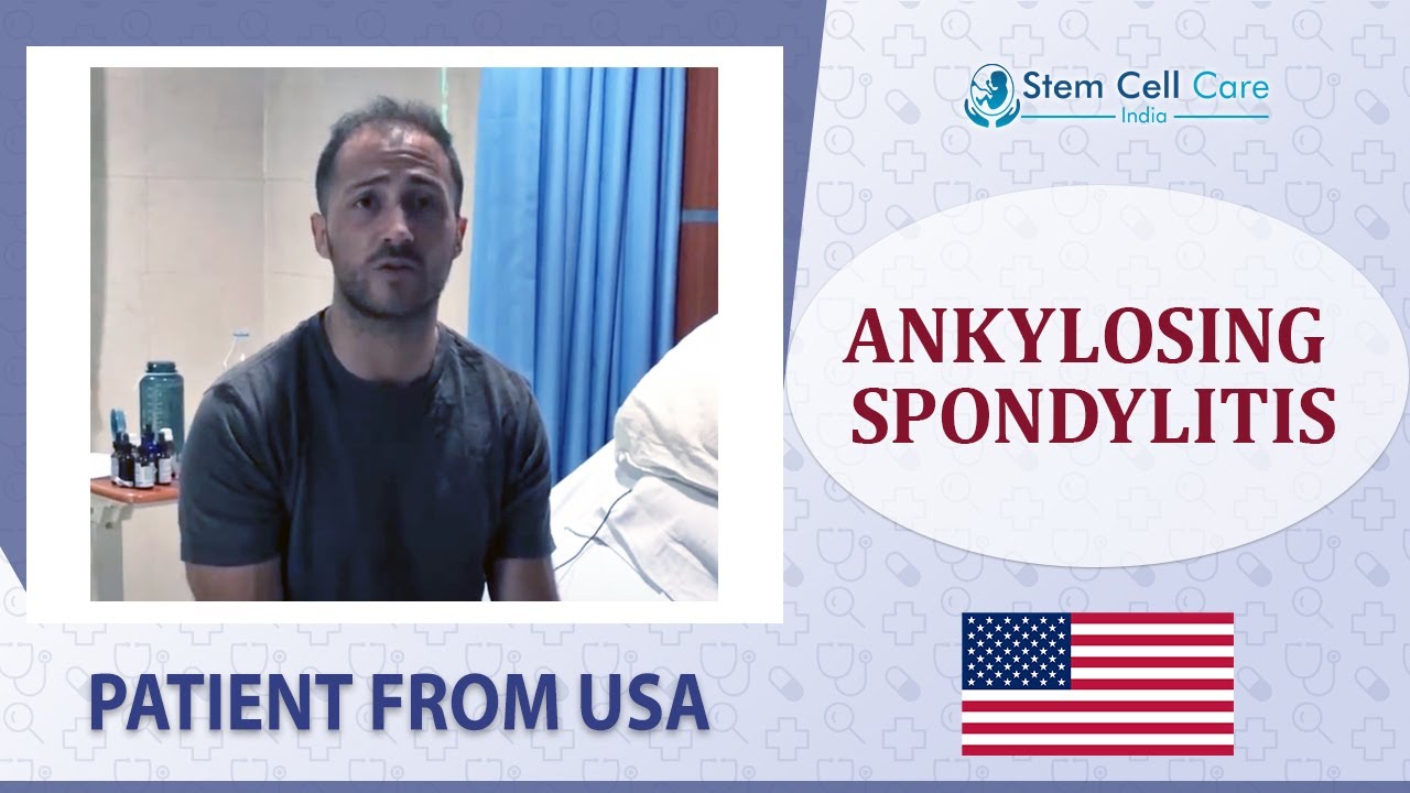 Patient with Ankylosing Spondylitis shares his experience at SCCI| Ankylosing Spondylitis treatment