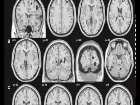 Video thumbnail for S.O.S SUS