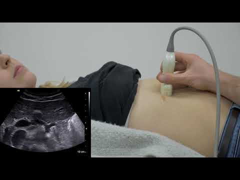 Behandlung von Prostatakrebs mit Metastasen Zwiebelsaft auf Prostata