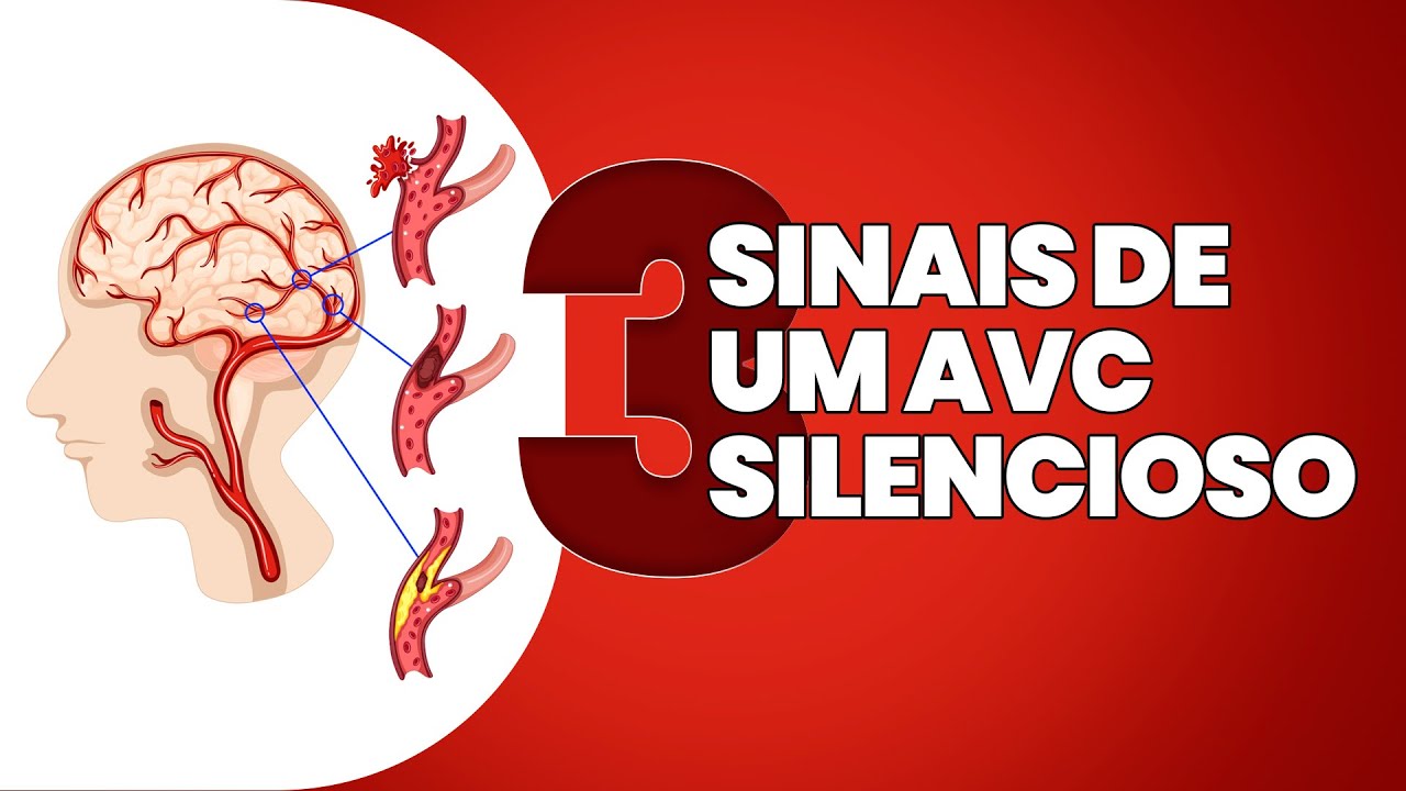 3 sinais de um AVC silencioso que são ignorados (descubra esses PERIGOS agora)