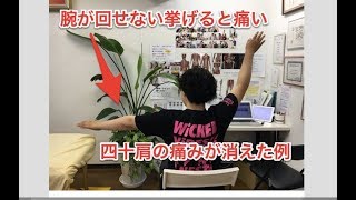 四十肩の痛みで腕が回らない上がらない腕が痛くなく、上がるようになりました。