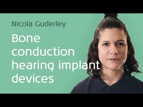 Bone conduction hearing implant (BCHI) devices: An interview with Nicola Guderley
