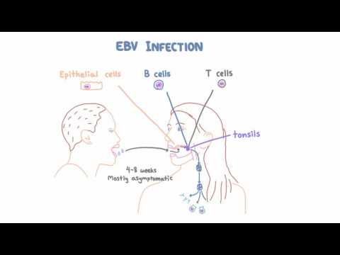 EBV and Mononucleosis - Pathogenesis and Clinical Presentation