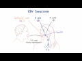 EBV and Mononucleosis - Pathogenesis and Clinical Presentation