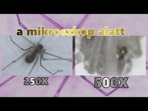 foldigilis mikroszkóp alatt)