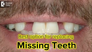 What is the best option for replacing missing teeth? - Dr. Ranjani Rao | Doctors