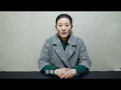 眉毛後段稀疏