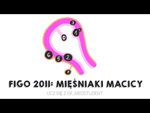 FIGO 2011: Mięśniaki macicy