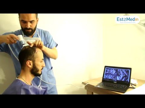 EsteMedin Fue Hair  Transplant Center istanbul / Turkey
