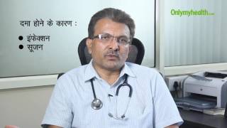 Why you should do allergy test in asthma in hindi
