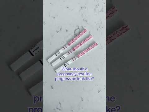 What Should an HCG (Pregnancy) Test Progression Look Like?