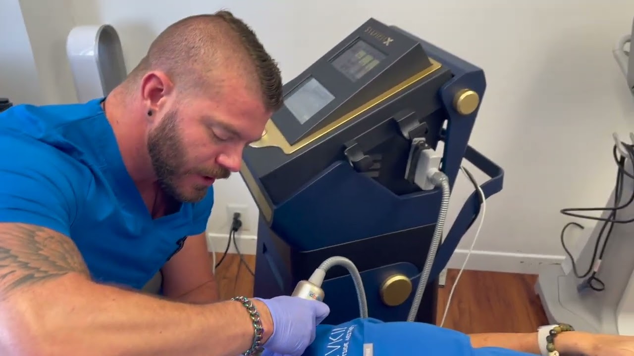 Los Angeles Sylfirm X Treatment | Santa Monica Radiofrequency/Microneedling Skin Tightening