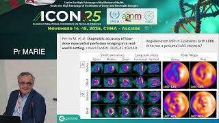 Discordance Scintigraphy-Coronary Angiography: Possible Explanations Pr MARIE