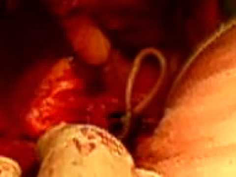 Para sa kung magkano ang maaari kang mawalan ng timbang sa pamamagitan ng 10 kg sa nutrisyon Ang magic salita para sa pagbaba ng timbang