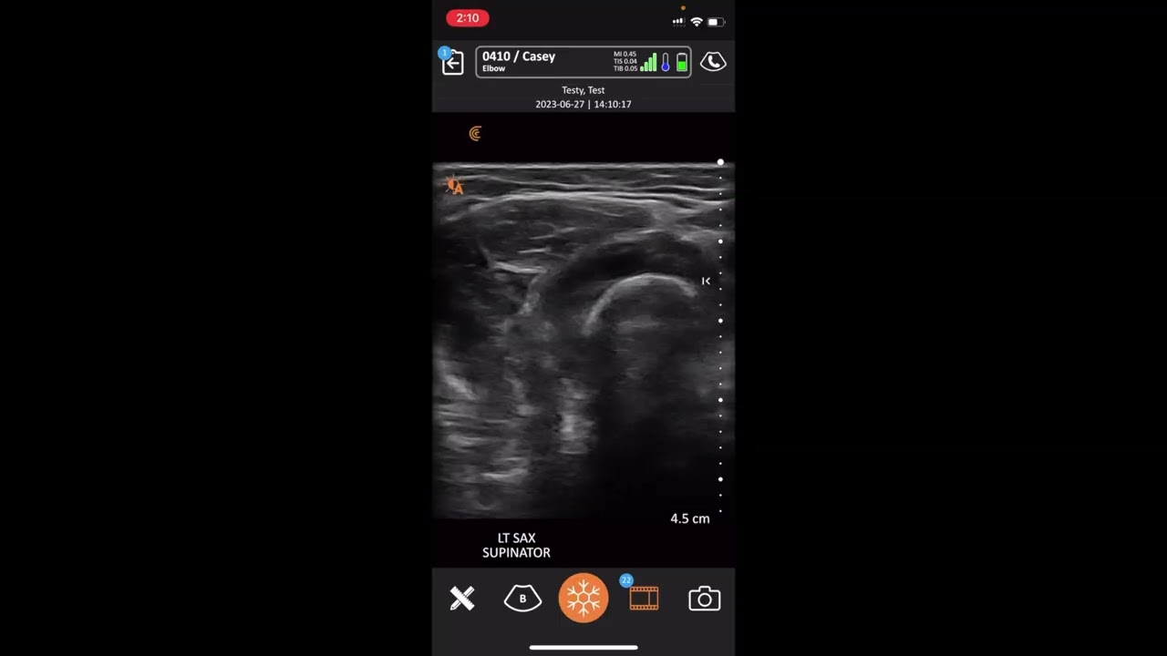 Clarius & EMAI Integration Tutorial