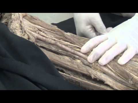 ◄╣ Muscles of the Front of the Thigh (Part 1) ╠►