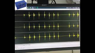Earthquake Monitoring at Dams: Vital Technology Explained