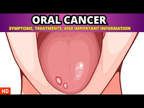 Malignant Peripheral Nerve Sheath Tumor Causes Signs and Symptoms Diagnosis and Treatment