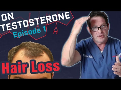 Hair Loss - On Testosterone Ep  1