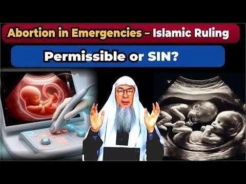 Terminating a Pregnancy in an Emergency - Sheikh Assim Al Hakeem #assim