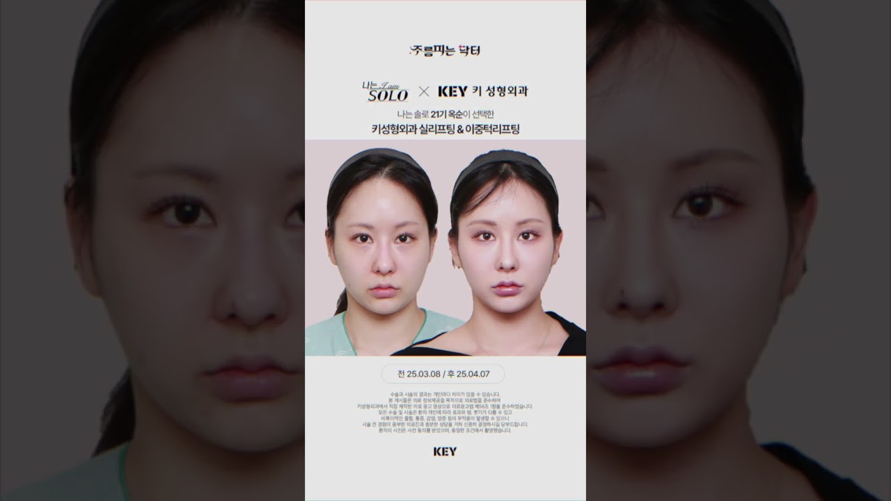 리프팅을 위한 21기 옥순의 선택 