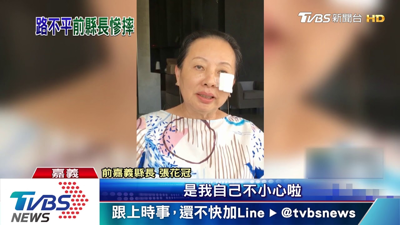 晨跑不慎仆街! 張花冠臉破相、左膝擦傷