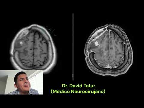 David Tafur Muñoz-3536