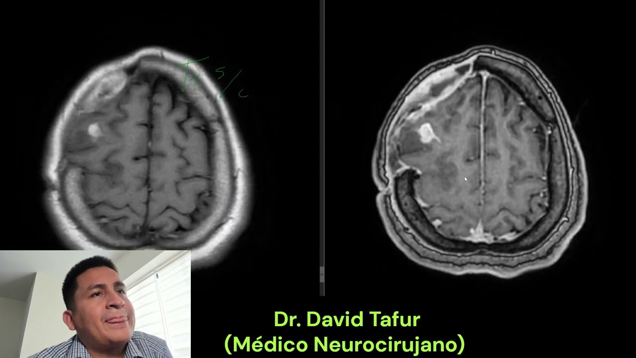 David Tafur Muñoz-2470