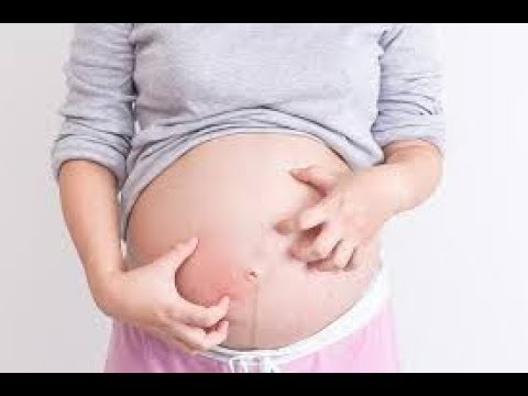 download lagu mp3 mp4 Tips Mengatasi Kulit Kering Saat Hamil, download lagu Tips Mengatasi Kulit Kering Saat Hamil gratis, unduh video klip Tips Mengatasi Kulit Kering Saat Hamil