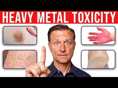 4 Skin Signs That Reveal Heavy Metal Toxicity