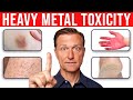 4 Skin Signs That Reveal Heavy Metal Toxicity