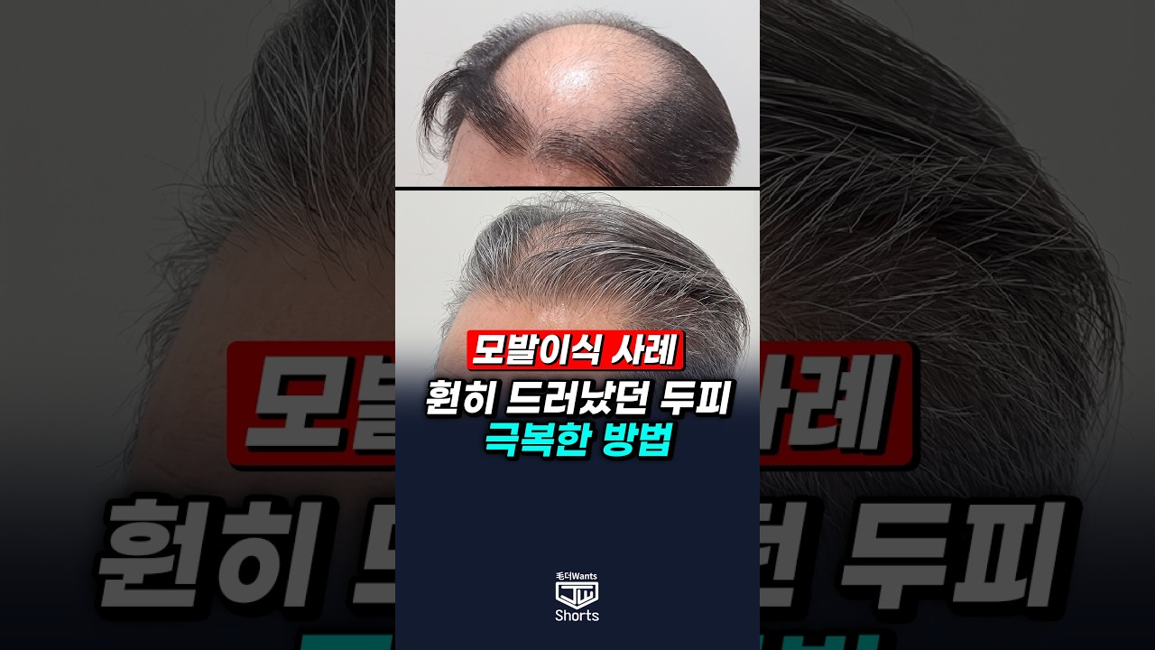 더원츠의원 숏폼