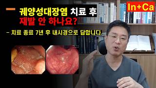 <Entity {'ja': '潰瘍性大腸炎は治療後に再発しませんか？ - 治療終了7年後の内視鏡で答えます。', 'ko': '궤양성대장염 치료 후 재발 안 하나요? - 치료 종료 7년 후 내시경으로 답합니다.', 'en': 'Does ulcerative colitis recur after treatment? - We answer with an endoscopy 7 years after the end of treatment.'}>